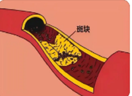 图片6.png